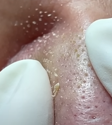 ΒΑΘΥΣ ΚΑΘΑΡΙΣΜΟΣ ΠΡΟΣΩΠΟΥ ONLINE COURSE